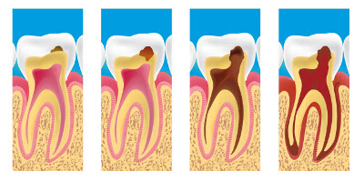 dentiste montreuil